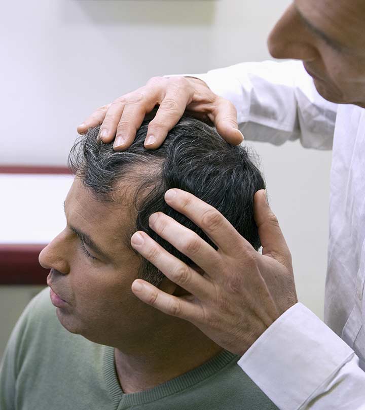 hair transplant